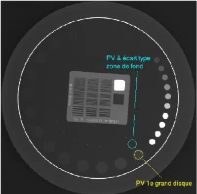 Figure 10 : Evaluation du contraste, bruit et CNR sur le fantôme de LEEDS. 