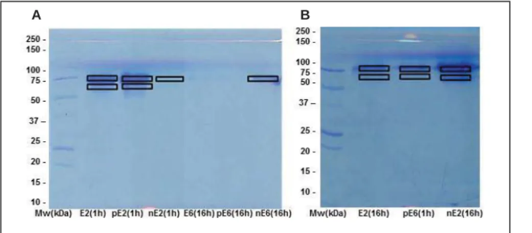 Fig. S2. 1D SDS-PAGE of elution fraction (A) E2 after 1 h incubation with 10% FBS supplemented cell culture  medium (eluted with 50 mM KCl) and E6 after 16 h incubation (eluted with 100 mM KCl) and (B) E2 after 16 h  incubation (eluted with 50 mM KCl)