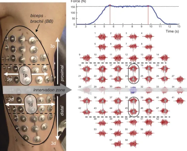 Fig. 1. One representative subject showing the electrode coverage over BB. On the right upper panel the force proﬁle of the isometric contraction