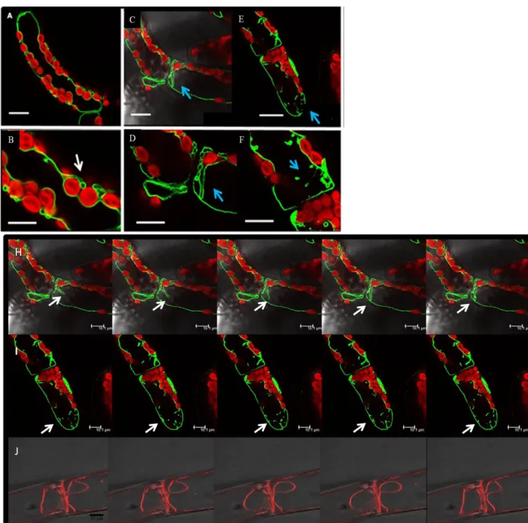 Figure 7: Dynamic of the vacuole visualized with the tonoplast reporter GFP-AtVAMP3