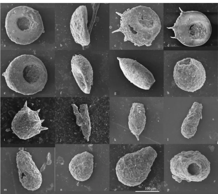 Fig. 2 SEM photos of testate amoebae from sediments of Lake Donghu, Wuhan, China. a – b) Cyclopyxis cf