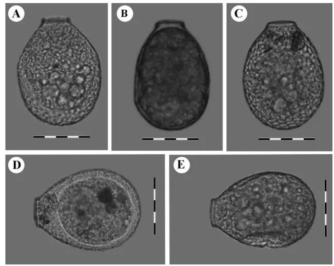 Fig. 2. Light micrographs of clade B cells (Nebela tincta): A. LC-86, B. LC-137, C. LC-117, D