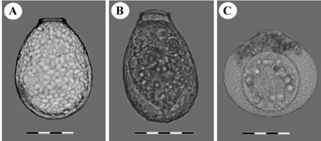 Fig. 6. Light micrographs of the remaining forms: A. Nebela aliciae n. sp. from Costa Rica, B