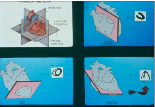 Figure 13: HLA, VLA et SA. Cours de Mr. Fleury E. 