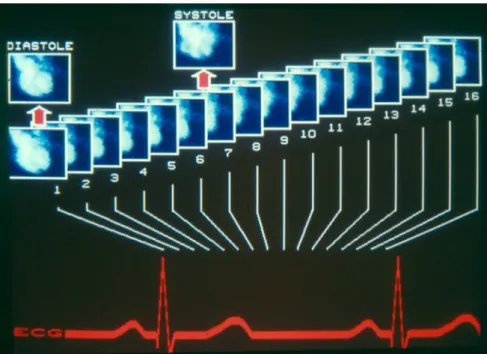 Figure 18: Gating cardiaque. Cours de Mr. Fleury E. 