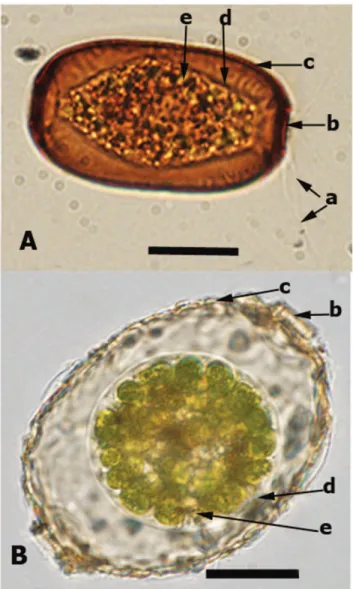 Figure 1. Light microscopy photograph for Archerella flavum (A) and Amphitrema wrightianum (B): the arrows indicate a) filose pseudopodia; b) pseudostome (shell aperture); c) shell (test);