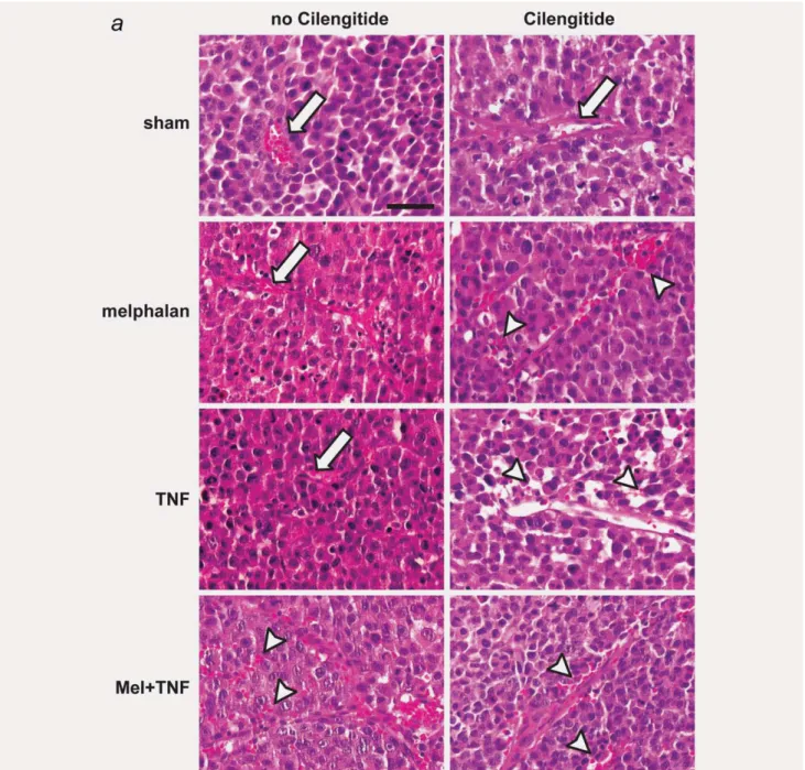 Figure 3. Histopathology of soft tissue sarcomas after cilengitide treatment in combination with a melphalan-based ILP
