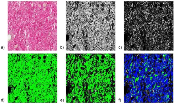 Figure 6   Analyse  de  la  microstructure  du  derme  réalisé  par  Ashling  Ni  Annaidh,  dans  le  cadre  du  projet  Ulysses