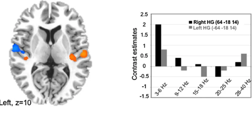Figure I.3 1 : Pattern oscillatoire intrinsèque des cortex auditifs. 