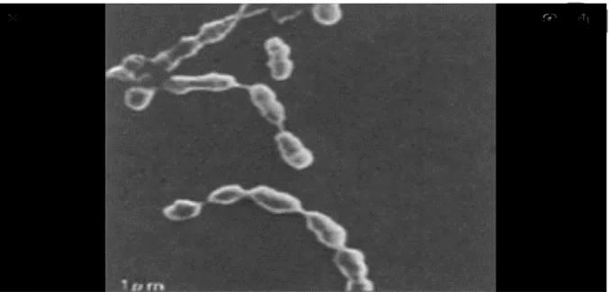 Figure 3 : Peptostreptococcus anaerobius, aspect des cellules en microscopie électronique  à balayage [13]