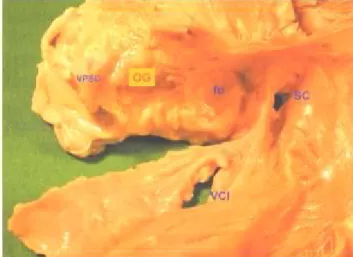 Fig 9. Vue montrant le septum inter-atrial.