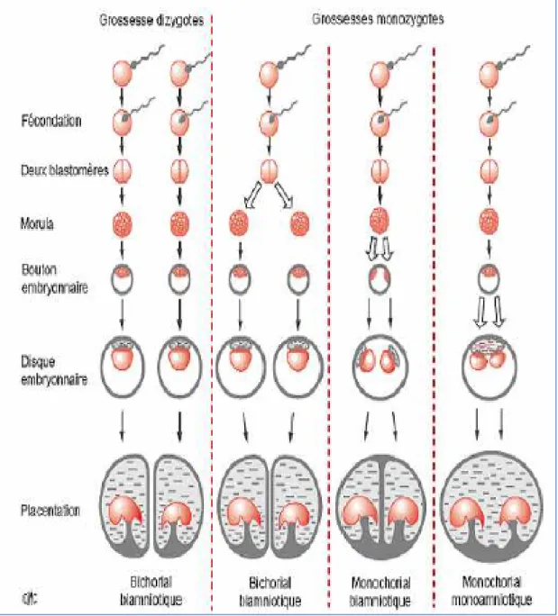 Figure 1: Différents types de grossesses gémellaires selon le stade de duplication (9) 