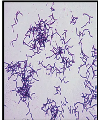 Figure 2 : Actinomyces israelii ramifié et           filamenteux [15]. 