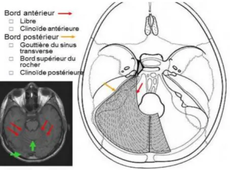 Figure 6 : vue supérieure montrant l’Hémi tente du cervelet [16]. 
