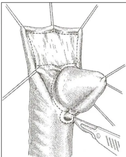 Fig. 26-1 : prise des mesures et  dessin du futur canal (la face 