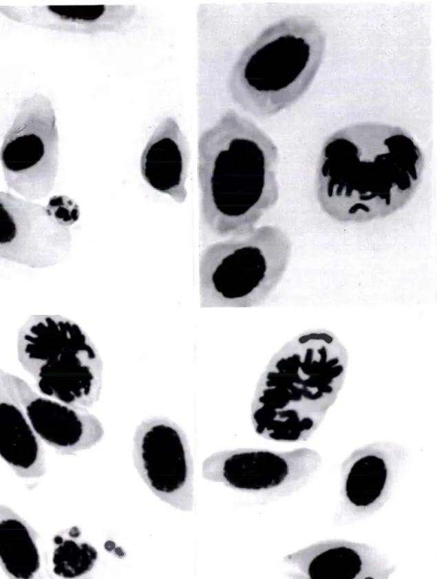 Figure  A  :  Difêrents  types  de  cellules  à  micronoyaux  observables  dans les  érythrocytes  des  -lârves 