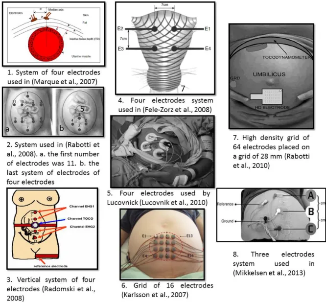 Figure 1.4: Different techniques used to record EHG signals. 