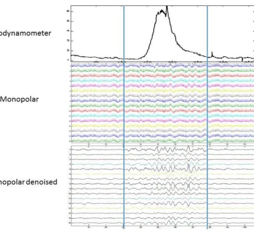 Figure   2.6 : Segmentation and Denoising of the recorded EHG signals. (a) TOCO signal used  for segmentation