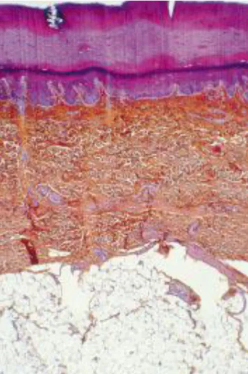 Figure 1 : Trois couches cutanées : épiderme, derme, hypoderme, bien visibles en  microscopie (9)