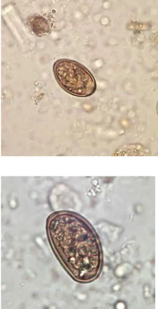 Figure 8: Œuf de Dicrocoelium dendriticum X 1000 (Laboratoire de Parasitologie et Mycologie,  Hôpital Militaire d’Instruction Mohammed V de Rabat) 