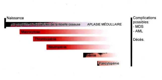 Figure  2 :  Evolution  des  symptômes  hématologiques  de  l’anémie  de  Fanconi(17) 