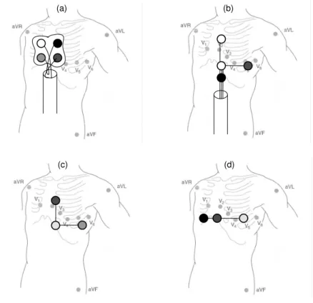 Fig. 4  Positions des électrodes de l’ECG utilisés pour le monitorage des patients et pour la  synchronisation de l’IRM
