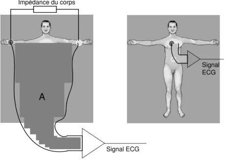 Fig. 15  L’induction dans deux cas différents. L’aire A est grande (induction grande) si l’on  utilise la position standardisée des électrodes (à gauche)