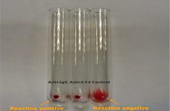 Figure 10 : Test direct à l’antiglobuline : la technique en tube [75]. 