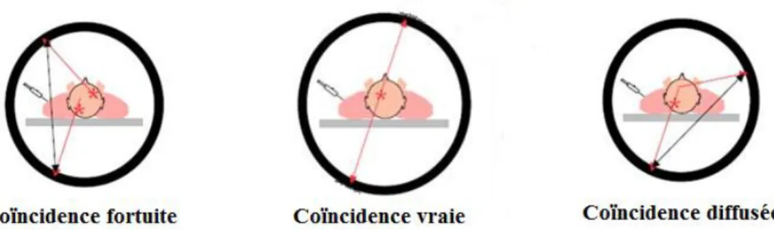 Figure 1.8.  Différents phénomènes de coïncidence qui peuvent intervenir en imagerie TEP