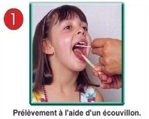 Figure 3 : Le Prélèvement 