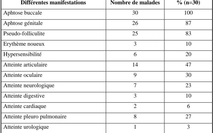 Tableau III : Les différentes manifestations non vasculaires de la maladie de  Behçet 