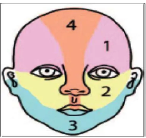 Figure 8 : Segmentation S1 à S4 des hémangiomes infantiles de localisation faciale [44]