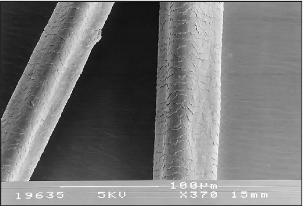 Figure 9 : Pili trianguli en microscopie électronique. [20] 