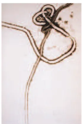 Fig. 6.1 – Le virus d’Ebola