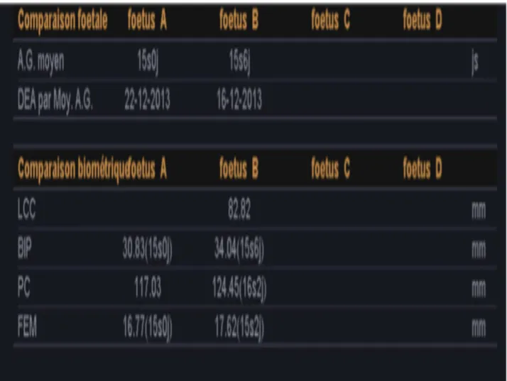 Figure 4: Biométrie des deux fœtus (A : intra-utérin ; B : abdominal) 