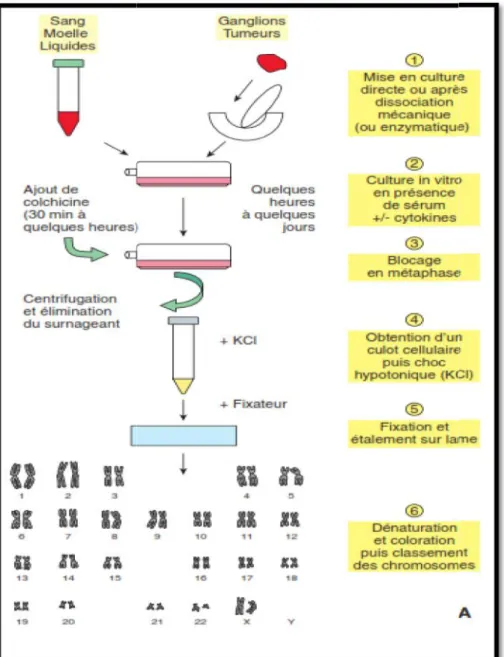 Figure 3 : étapes de la réalisation du caryotype [26]