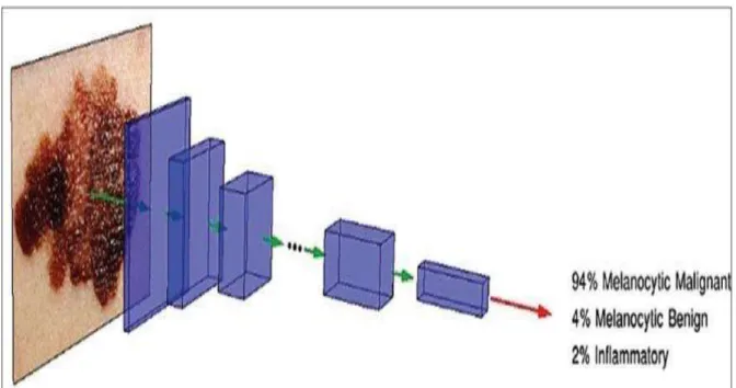 Figure 8: l'IA en action, Un DNN calcule la probabilité de malignité pour chaque image 