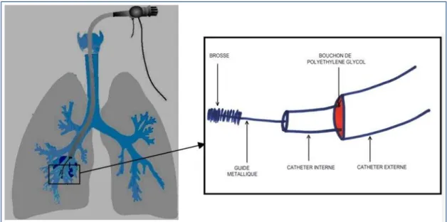 Figure 9 : Dispositif de Wimberley [99] 