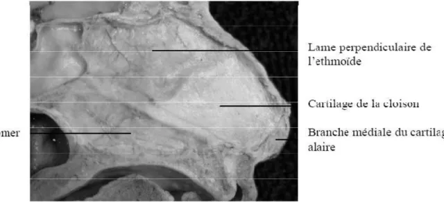 Figure 9: Montrant la structure ostéo-cartilagineuse de la cloison nasale 