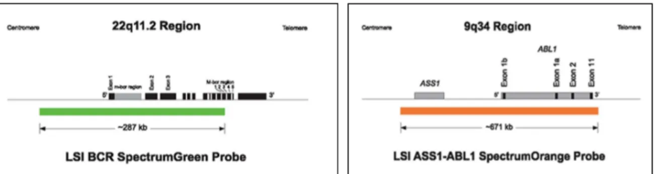 Figure 10: Localisation de la sonde LSI BCR/Abl double fusion double couleur au niveau  chromosomique