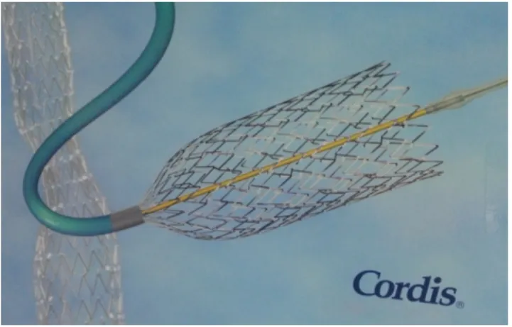 Figure 10 : stent auto expansible (CORDIS) 