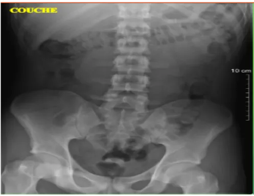 Figure 7: ASP en position couchée 