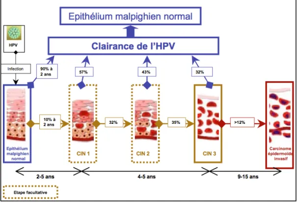 Figure 13: Histoire naturelle du carcinome épidermoïde du col de l’utérus. [28] 