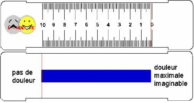 Figure 5: réglette de mesure de l’EVA 