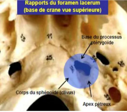 Figure 7 :  Rapports du foramen lacerum sur une vue supérieure de la base du crâne. 