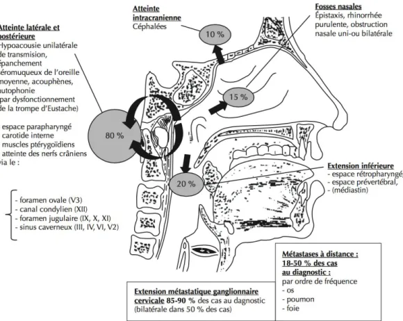 Figure 9 :  Schéma anatomique de profil de la face et du cou résumant   les voies d’extension des cancers du cavum.(30) 