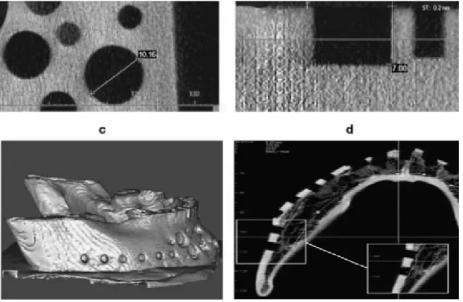 Figure 11: Les mesures linéaires avec CBCT. 