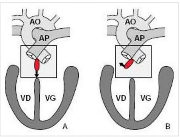 Fig. 1 : embryogenèse de la T4F. [6] 