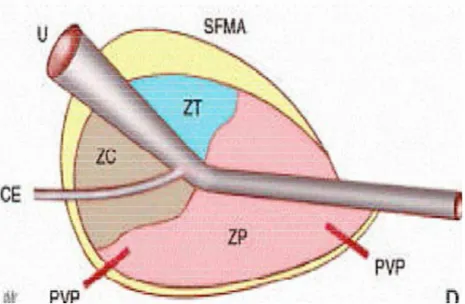 Fig. 2 : Schéma de l’anatomie zonale de la prostate 