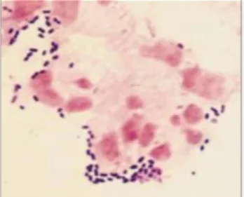 Figure 15: Vue au microscope après coloration de gram [18] 